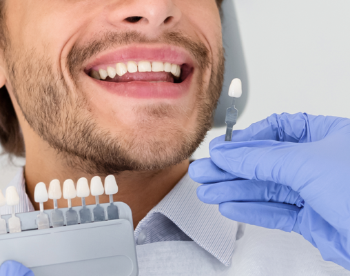 Limpieza Dental Clinica Barrantes