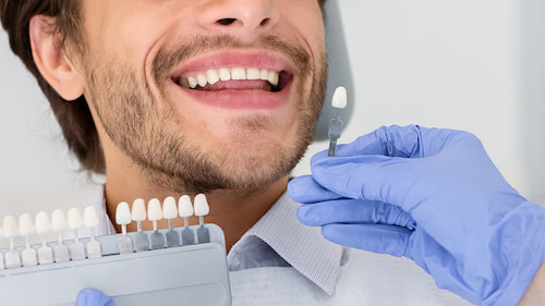 limpieza dental en Cáceres, carillas dentales