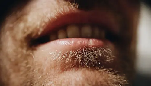 Especialistas en halitosis en Cáceres