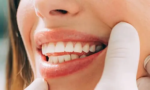 Blanqueamiento dental GRATIS con tu tratamiento de Ortodoncia en Cáceres 2021