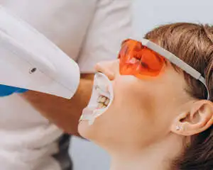 blanqueamiento dental después de la ortondoncia en Cáceres capital, dentistas especializados en brackets metálicos, Brackets metálicos a precio económico