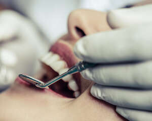 Tratamientos dentales en Cáceres, la Mejostilla