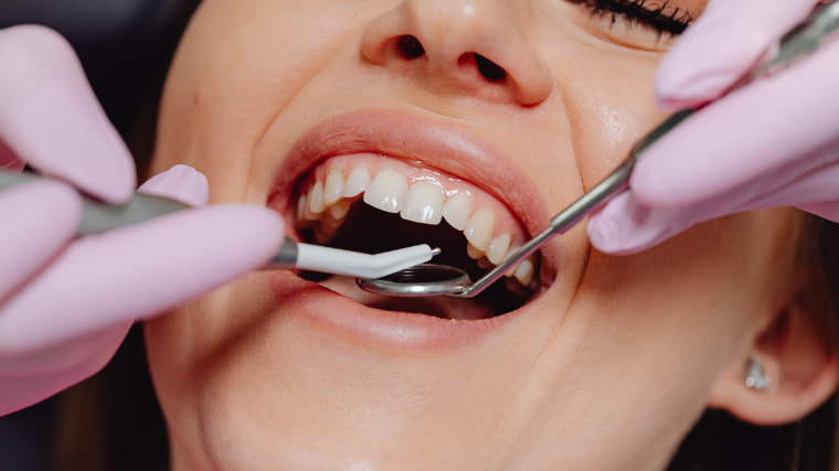 ¿Sabías que una limpieza dental profesional es clave para mantener tu salud bucal?