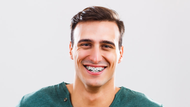 ¿La ortodoncia cambia el perfil facial de tu cara?