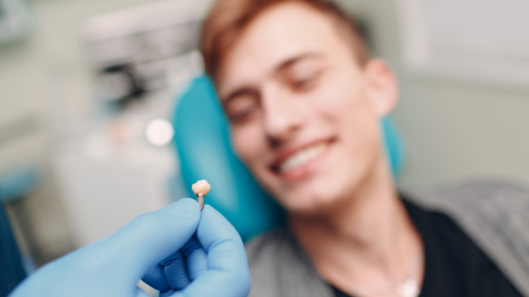 ¿Cuánto tarda en cicatrizar un implante dental?