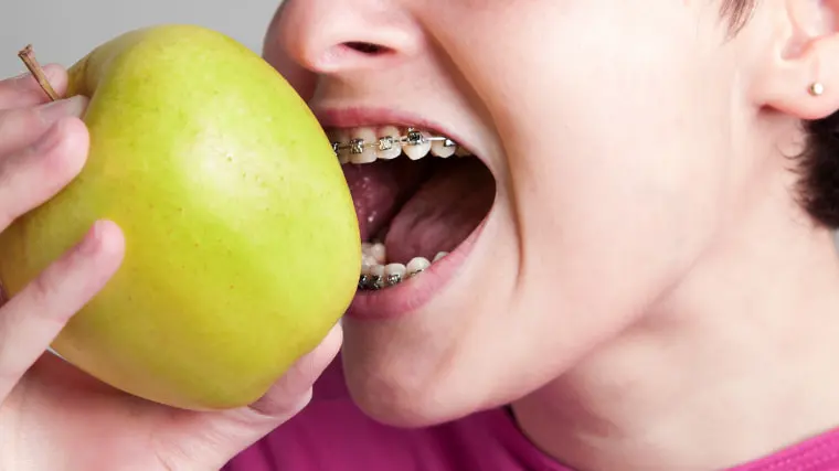 se puede comer con cera de ortodoncia
